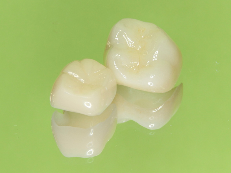 根管治療後のかぶせもの